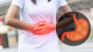Nutrition rules for gastric gastritis
